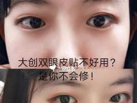 如何贴内双双眼皮贴？大创和素肌推荐