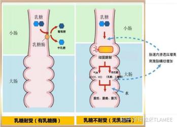 乳糖不耐症：婴儿和成人时期的消化问题及解决方法