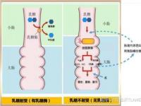 乳糖不耐症：婴儿和成人时期的消化问题及解决方法